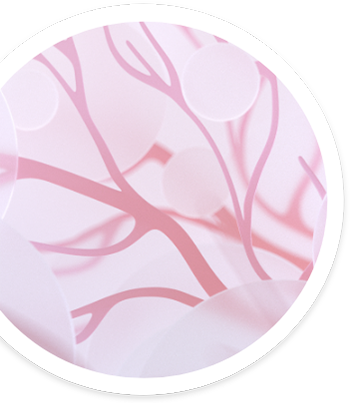 anca-associated-vasculitis-sm