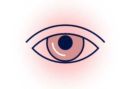 Eye