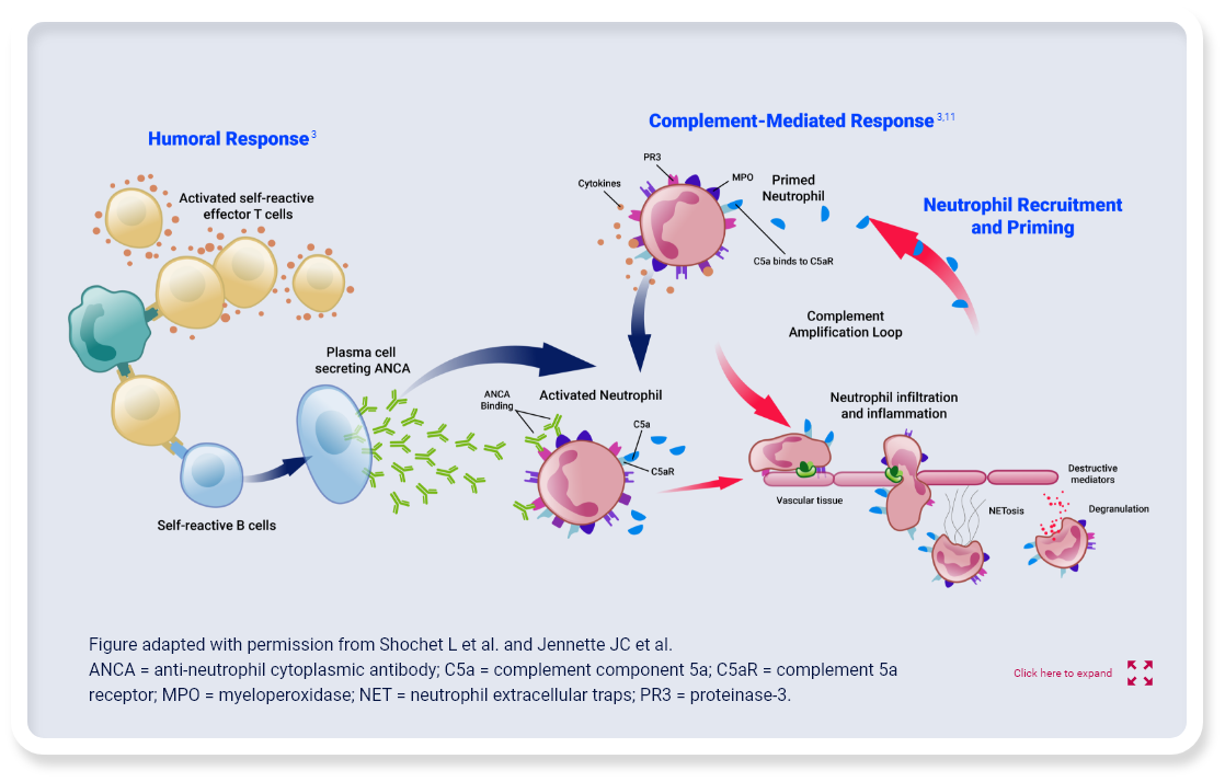 Mechanism of disease for severe active ANCA-associated vasculitis