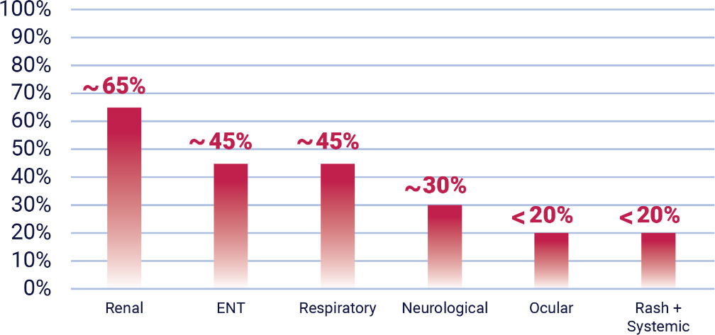 Rarity and Nonspecific Presentation of Severe Active
GPA and MPA